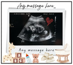 Baby Scan Photo Personalised Candle | Baby Ultrasound Gift | New Parent Gift | Baby Shower | Gender Reveal Scan | New Parents | Grandparents Etsy