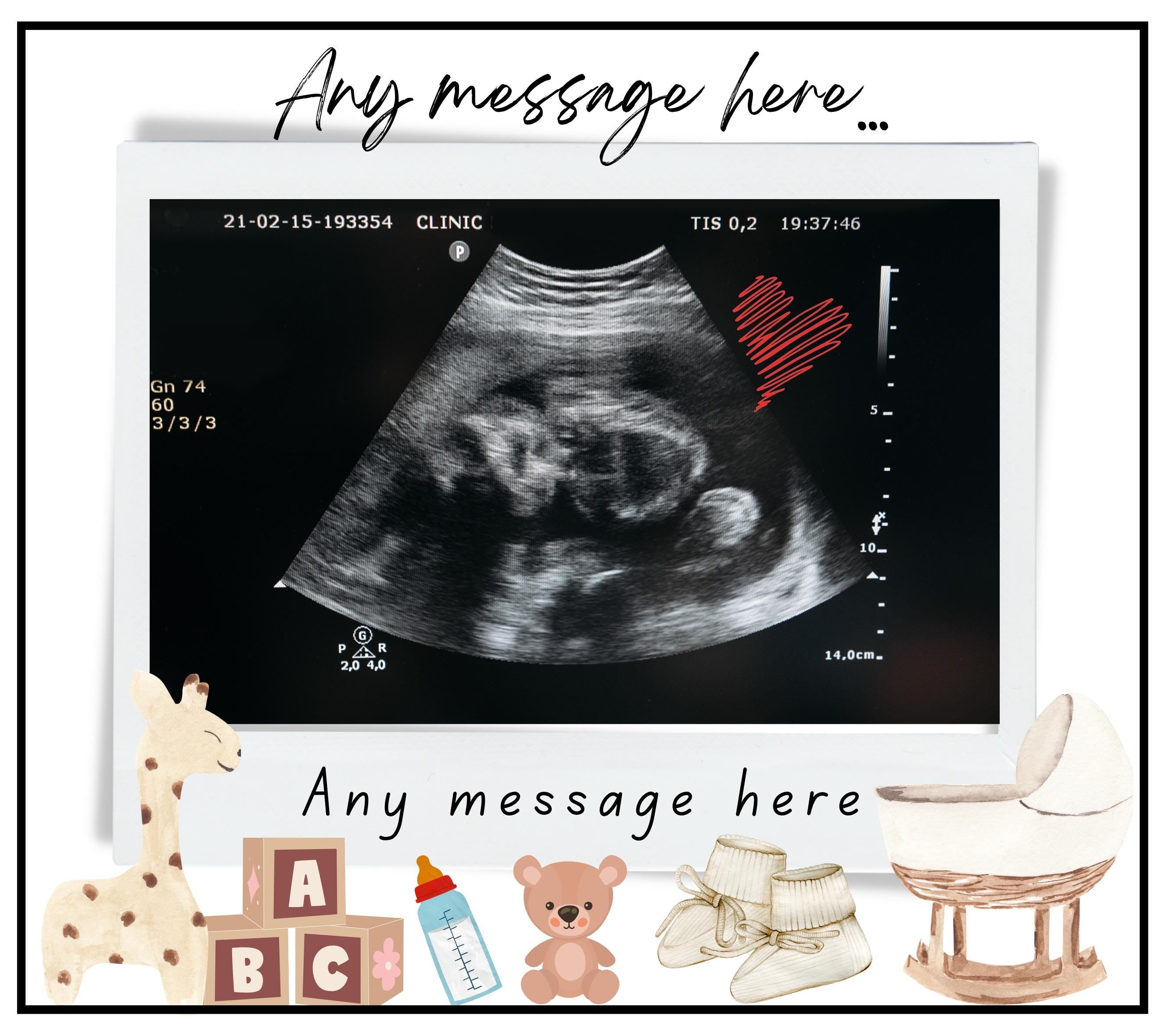 Baby Scan Photo Personalised Candle | Baby Ultrasound Gift | New Parent Gift | Baby Shower | Gender Reveal Scan | New Parents | Grandparents Etsy